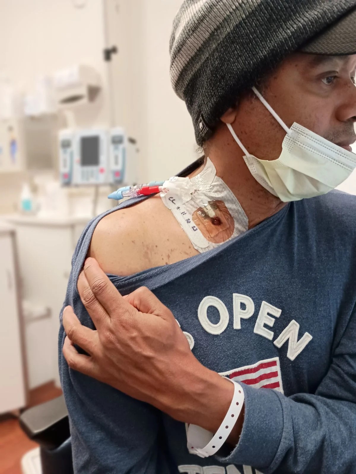 Larry Holliday, wearing a stocking cap, protection mask and a blue shirt, shows where the medicine enters his body. 